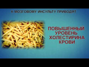 Мозговой инсульт можно предотвратить